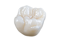DVine-Dental-Arts_Zirconia Crowns